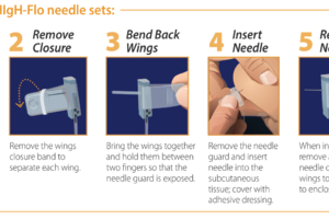 HIgH-Flo Needles