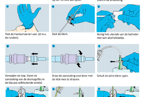 Pleural Drainage