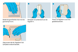 Pleural Drainage